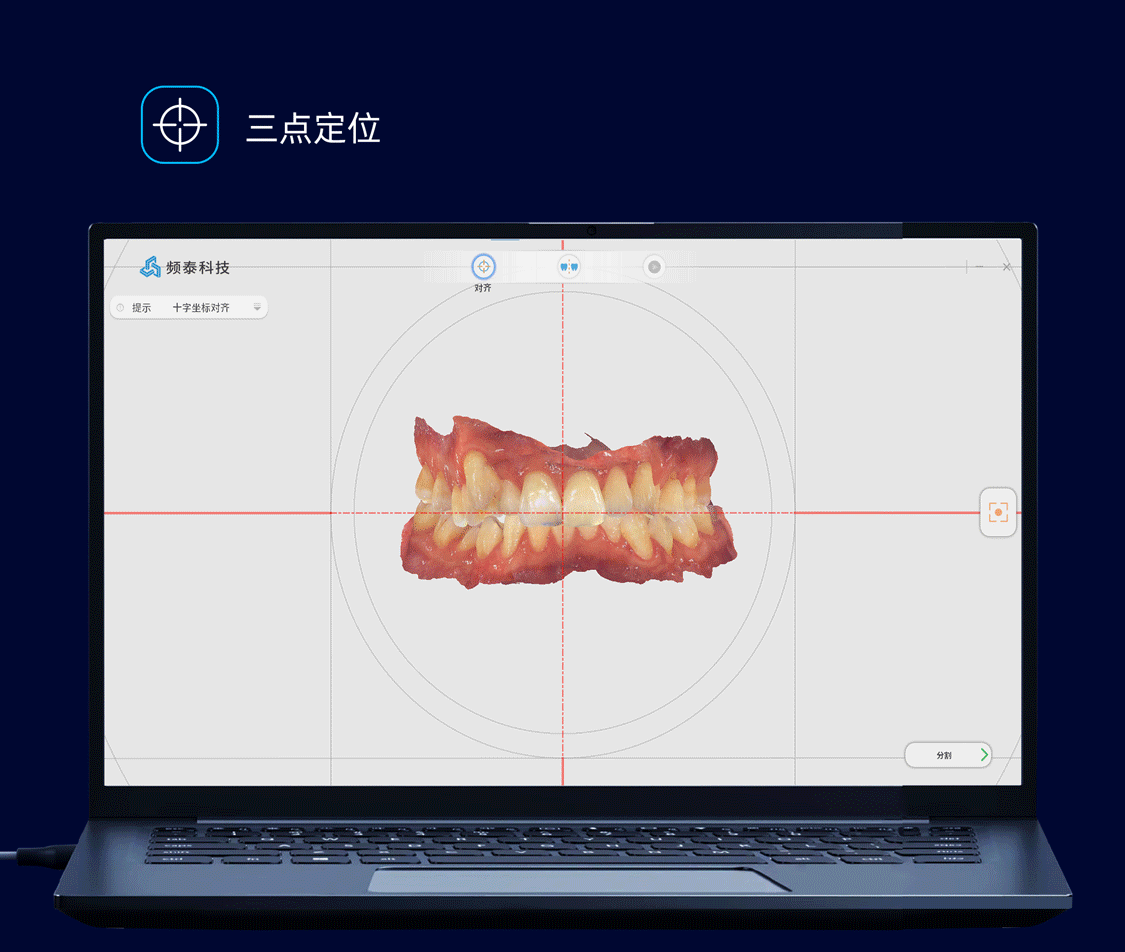 正畸电脑.gif